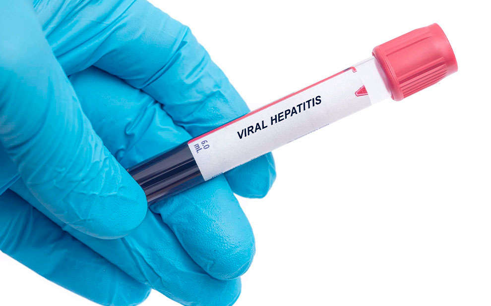 Read more about the article Enfrentamento às hepatites virais traz aprendizados para lidar com novas emergências de saúde